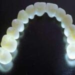 exzirkonyum_1-833980