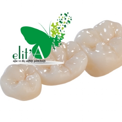 small2782016130453THCTPU
